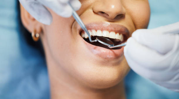 Best Broken or Cracked Tooth Emergency Dentist in Hildale, UT